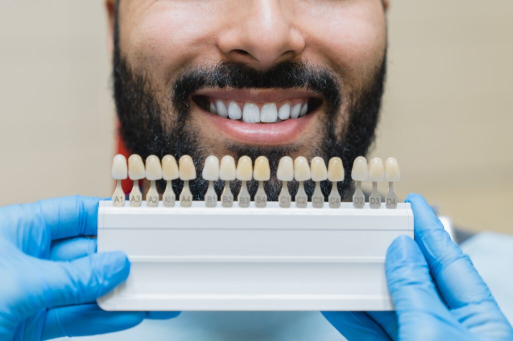 Dentist at Northside Family Dentistry in O'Fallon, MO, holding veneer shade samples to match a male patient’s teeth for a custom smile transformation.